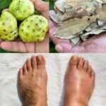 El Tónico Curativo Definitivo para Pies Hinchados y Mala Circulación
