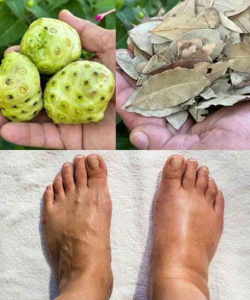 Ingredientes naturales para el tónico curativo: noni y laurel