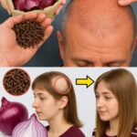 Remedios Naturales para el Crecimiento del Cabello: Cebolla y Clavos de Olor
