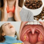 Clavos de Clavo: El Antibiótico Natural para Combatir el Dolor de Garganta y la Inflamación