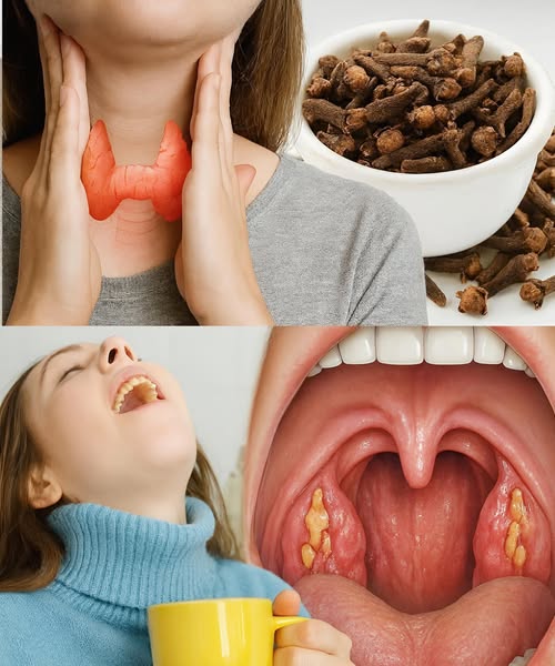 Clavos de Olor