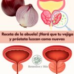 Cebolla y Cáscaras: Remedios Naturales para la Vejiga y Próstata