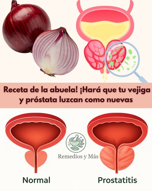 Remedios naturales para la vejiga y próstata con cebolla