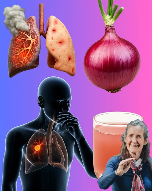 Remedio natural de cebolla para la salud pulmonar