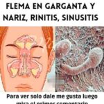 Remedios Caseros para Eliminar Moco, Flema y Rinitis