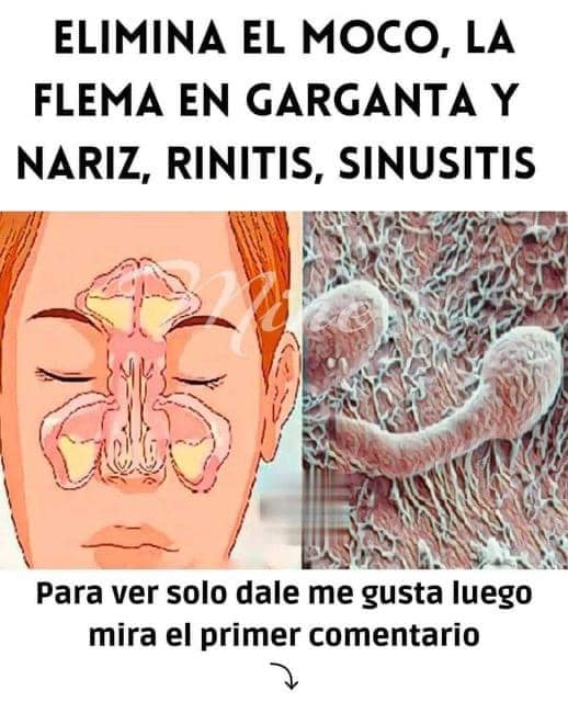 Ilustración de Senos Paranasales