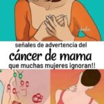 Señales de Advertencia del Cáncer de Mama: Lo Que Necesitas Saber