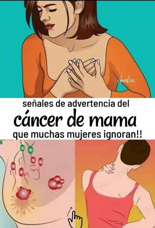 Señales de advertencia del cáncer de mama