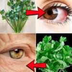 Descubre el Poder del Perejil: Un Remedio Natural para Mejorar tu Salud Ocular