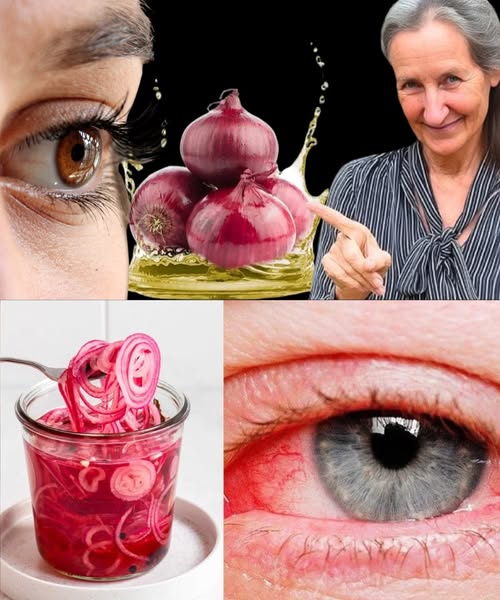 Beneficios de la cebolla roja para la salud ocular