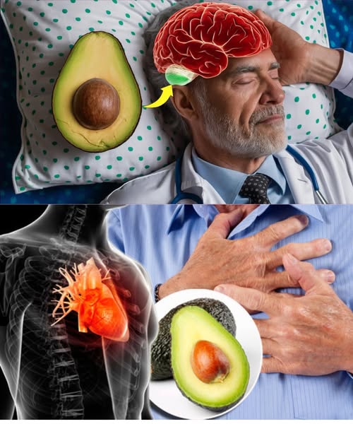 Beneficios del Aguacate en la Salud