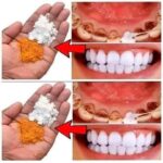 Remedio Casero para Blanquear los Dientes en Solo 2 Minutos