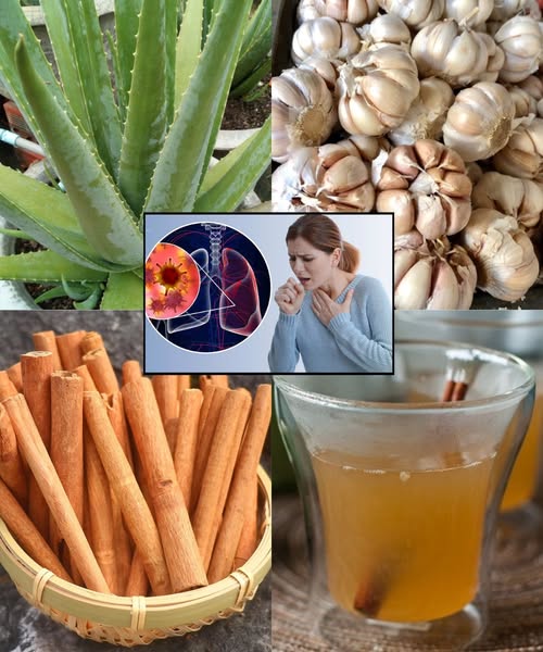 Remedios Naturales