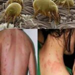 Cómo Combatir Alergias por Ácaros del Polvo: Remedios Naturales y Consejos