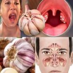 Los Increíbles Beneficios del Ajo Crudo para la Salud Respiratoria