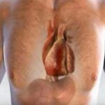 ¿Está tu corazón en riesgo? Señales de alerta de un infarto