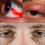 Señales en Tus Ojos que Indican Problemas de Salud Ocular