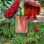 El Zumo del Zumoque: El Árbol que Podría Reemplazar la Mitad de Tu Botiquín