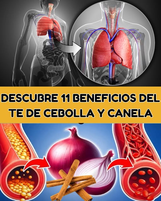 Beneficios del Té de Cebolla y Canela
