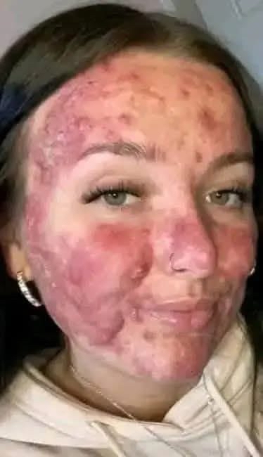 Remedios naturales para el picor en la piel