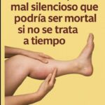 Combatir y Prevenir la Trombosis con Remedios Naturales