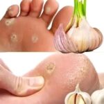 Señales en tus PIES que Indican que Están Enfermos y Cómo Tratarlos con Ajo