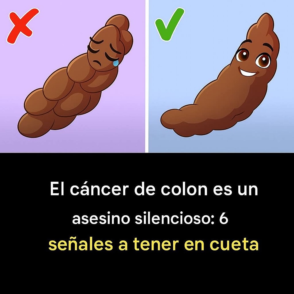 Cáncer de Colon