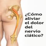 Alivio Natural del Dolor del Nervio Ciático: Remedios Efectivos