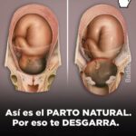 El Parto Natural Sin Anestesia: Experiencia Transformadora