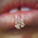 Beneficios de los Remedios Caseros para el Bienestar Integral