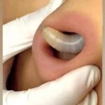 El Impacto de los Remedios Naturales en la Salud Auditiva