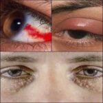 Señales en tus Ojos que Indican Problemas de Salud