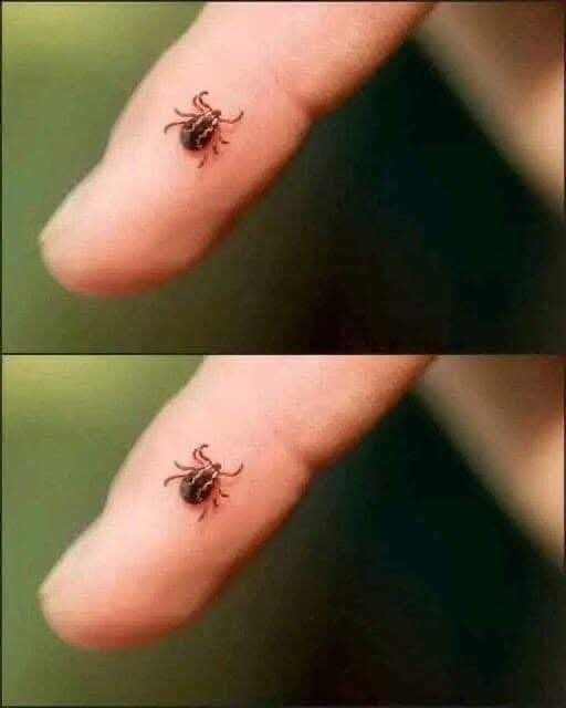 Garrapata adherida al dedo humano