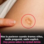 La Cicatriz de la Vacuna BCG: Una Historia Compartida