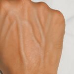 Las Venas Alteradas en las Manos: Signos y Soluciones Naturales