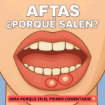 Aftas Bucales: Causas, Síntomas y Remedios Naturales Efectivos