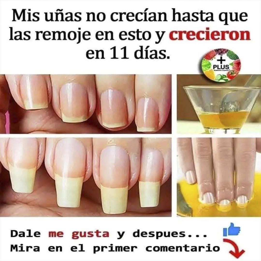 Remedio casero para hacer crecer las uñas