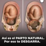 El Parto Natural Sin Anestesia: Una Experiencia Transformadora