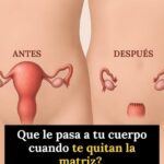Efectos Menos Conocidos de una Histerectomía en el Cuerpo de la Mujer