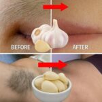 ¡Deja de Afeitarte! Descubre Cómo Eliminar el Vello Facial, Corporal y Púbico de Manera Natural Utilizando Ajo