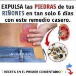 Expulsa las Piedras de tus Riñones de Forma Natural y Efectiva