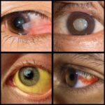 Signos de Alerta: Salud Ocular que No Debes Ignorar