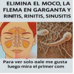 Elimina el Moco y la Flema de Forma Natural: Remedios Caseros Efectivos
