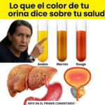 Lo que el Color de tu Orina Dice Sobre Tu Salud: Un Análisis Detallado