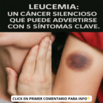 Leucemia: Conoce los 5 Síntomas Clave para Detectarla a Tiempo