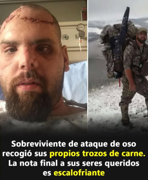 Sobreviviente de ataque de oso