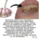 Remedios Caseros para Hongos en las Uñas: Ajo, Vinagre y Bicarbonato