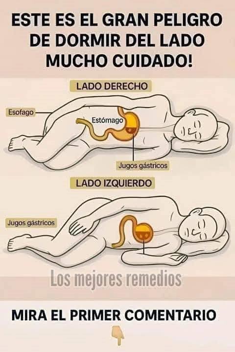 Gráfico que muestra el efecto de dormir del lado derecho e izquierdo sobre el estómago y los jugos gástricos