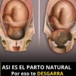 Cómo Afrontar el Parto Natural: Salud y Remedios Naturales