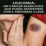 Leucemia: Identificando sus 5 Síntomas Silenciosos